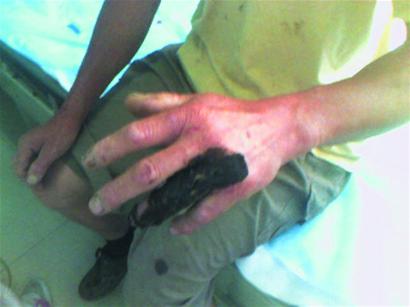 天悶熱蛇出沒 1米青蛇咬傷茶農被其妻一鋤頭砍死