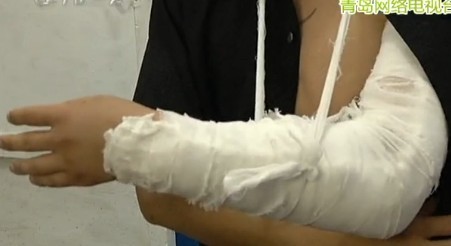 青島廚師剔骨頭砍到手血如噴泉 手筋砍斷血沾滿出租 青島廚師剔骨頭砍到手血如噴泉 手筋砍斷血沾滿出租