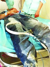 年輕男子遭電流擊穿身體 尚未見(jiàn)過(guò)初生女兒