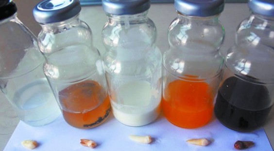 喝啥飲料最傷牙 實驗證實可樂損傷牙釉質