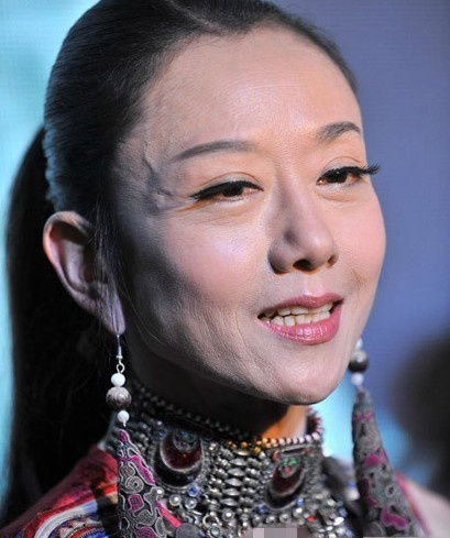 揭楊麗萍終身不育內幕 老公劉淳晴出身商業世家