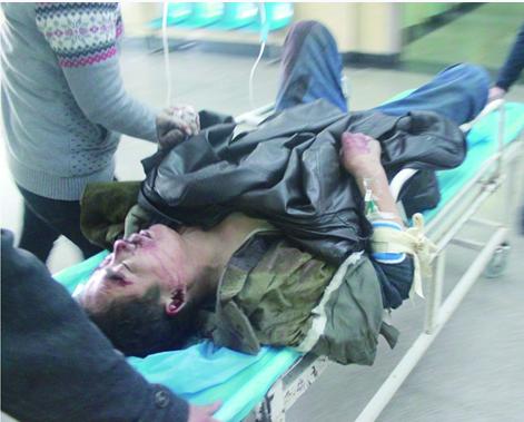 工人摔下腳手架顱骨塌陷 負責人竟笑稱小事 工人摔下腳手架顱骨塌陷 負責人竟笑稱小事