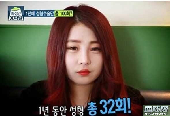 韓國整容節目驚現芭比娃娃 整容成癮3年100次手術